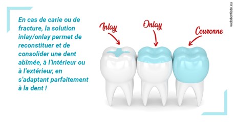 https://dr-marc-andre-benguigui.chirurgiens-dentistes.fr/L'INLAY ou l'ONLAY