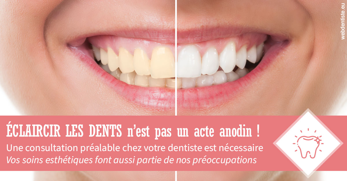 https://dr-marc-andre-benguigui.chirurgiens-dentistes.fr/Eclaircir les dents 1