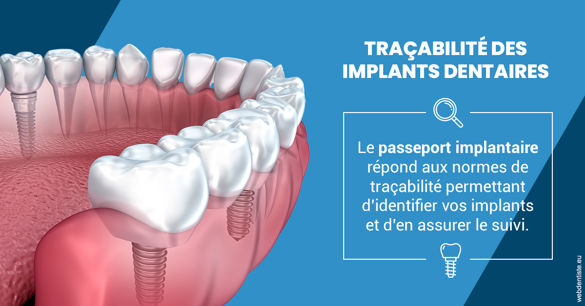 https://dr-marc-andre-benguigui.chirurgiens-dentistes.fr/T2 2023 - Traçabilité des implants 1
