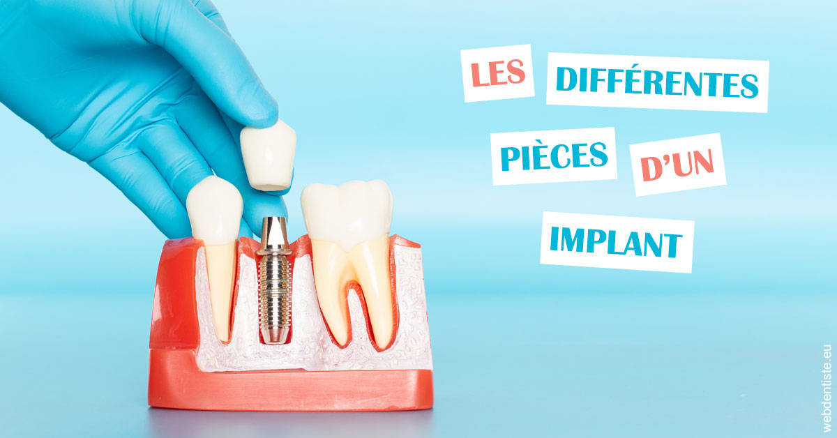 https://dr-marc-andre-benguigui.chirurgiens-dentistes.fr/Les différentes pièces d’un implant 2
