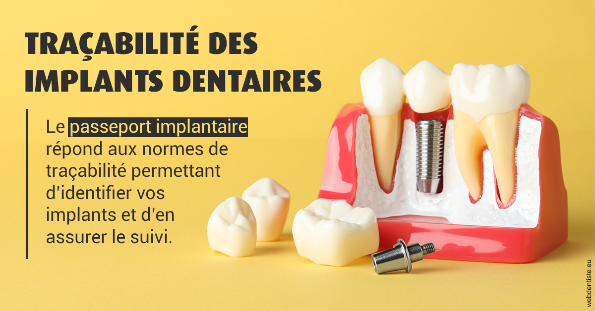 https://dr-marc-andre-benguigui.chirurgiens-dentistes.fr/T2 2023 - Traçabilité des implants 2