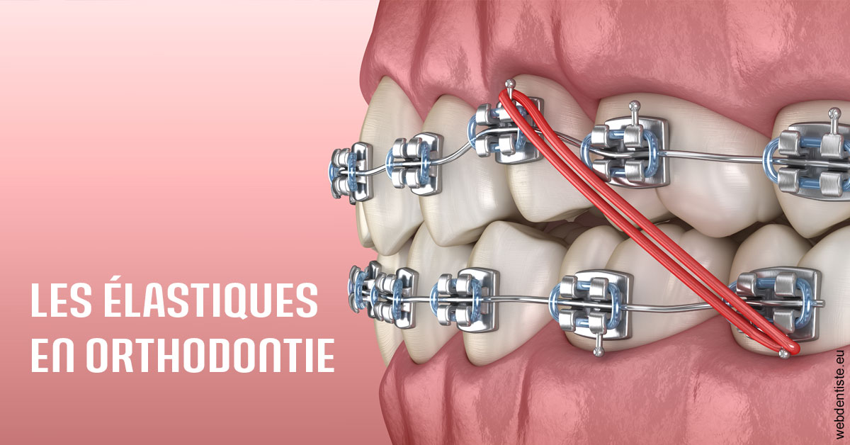 https://dr-marc-andre-benguigui.chirurgiens-dentistes.fr/Elastiques orthodontie 2