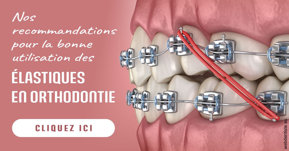 https://dr-marc-andre-benguigui.chirurgiens-dentistes.fr/Elastiques orthodontie 2